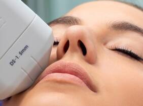 Madrid Sesión de HIFU facial 7D con radiofrecuencia en zona a elegir