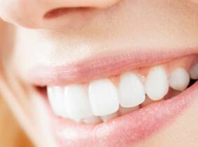 Granada Examen dental (limpieza